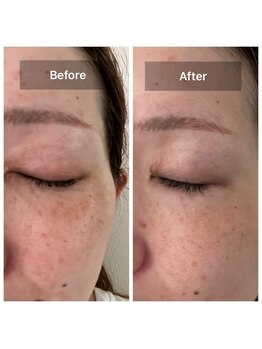 アットユウ(@yu)/フェムフェイシャル