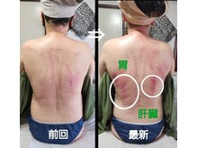 オアシス(OASIS)/デトックスかっさ