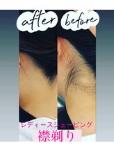 ピリナ(Pilina)/襟足Before after
