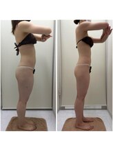 リッツ 浦和ボディ店(Ritz)/【Before/After】痩身