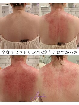 アンテ(Aunte.)/漢方アロマかっさ×リンパ