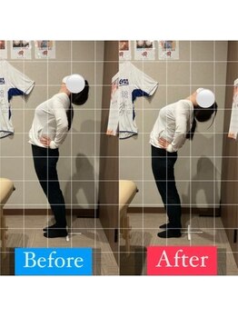 ナオル整体 宮崎院(NAORU整体)/30代女性施術事例【反り腰改善】