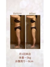 エメカシワ(Aimer KASHIWA)/30代　月1回　5ヶ月での変化