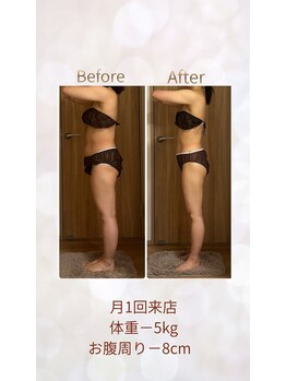 エメカシワ(Aimer KASHIWA)/30代　月1回　5ヶ月での変化