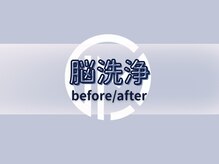 エルミオ エスパシオ ミロク(El mio espacio 369miroku)/脳洗浄Before＆After