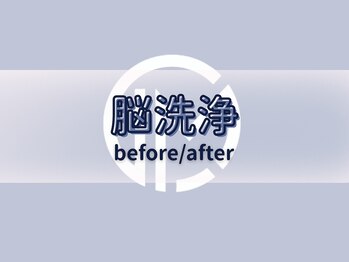 エルミオ エスパシオ ミロク(El mio espacio 369miroku)/脳洗浄Before＆After