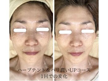 こもれび/１回のお手入れでの変化