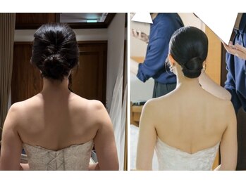 キュアボディ(Cure Body)の写真/結婚式までに理想の自分へ☆筋膜リリース骨盤矯正で美姿勢・歪みとり・小顔効果をサポート！