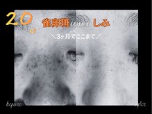 シアラ(SHIARA)の雰囲気（20代の肌、3ヶ月でここまできれいに！）