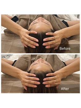 ステラルーテ(Stella lute)/知らないうちに頭浮腫んでます！