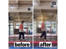 カワル整体 上通り院/腰痛をかばって背中が丸くなる