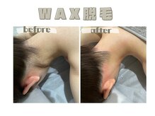 レヴィート(Revept)/【ワックス脱毛】