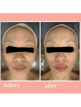 ウララン(URARAN)/コルギのお客様