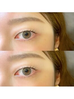 エン(EN.)の写真/カウンセリング重視サロン■一重、奥二重、瞼が重い、目元のコンプレックス解消のお手伝いに！