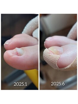 爪切り屋 足楽/