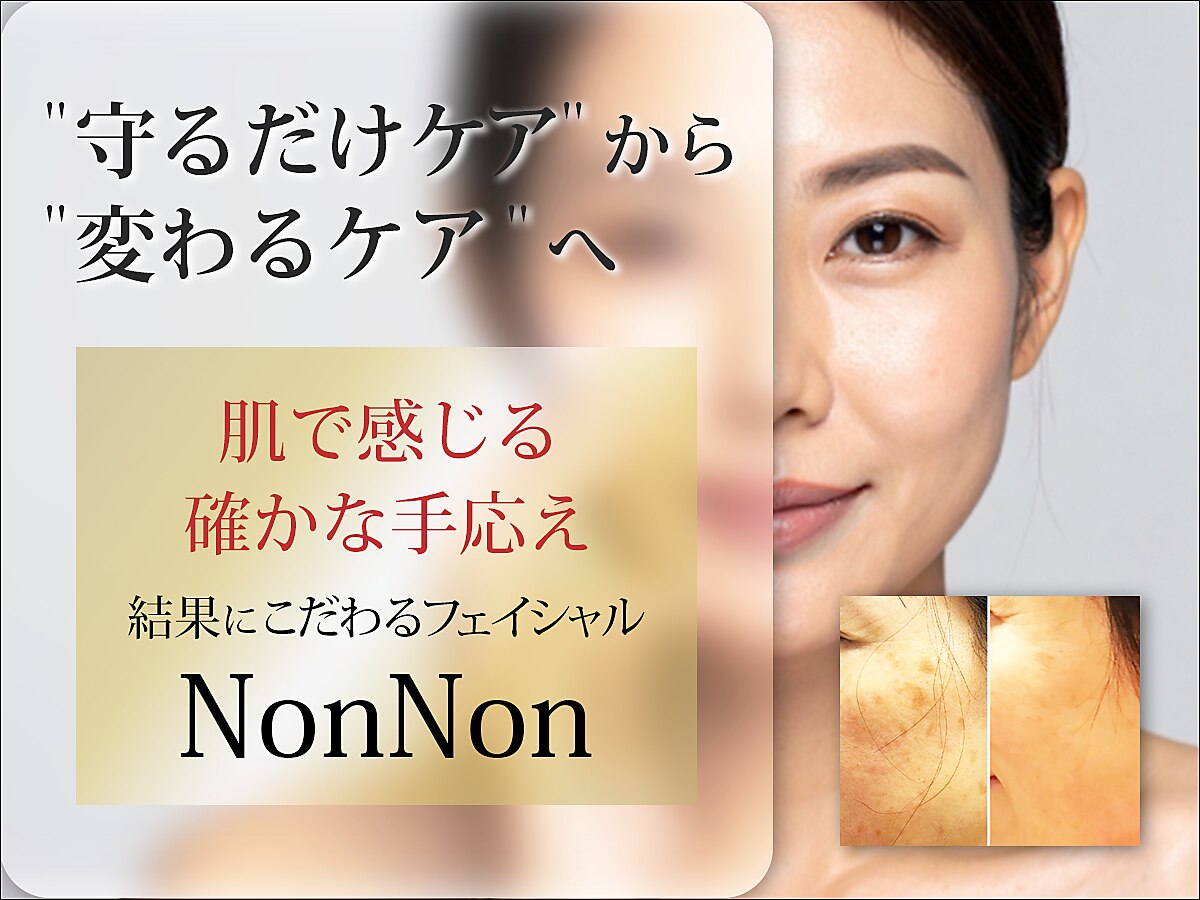 ノンノン(NonNon)｜ホットペッパービューティー