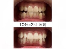 エム(M)/１０分×２回　６来店のお客様