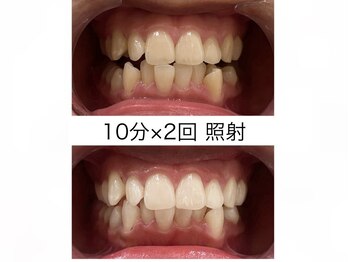 エム(M)/１０分×２回　６来店のお客様