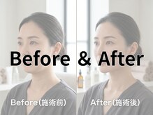 パリス デ スキン イオンモール柏店/