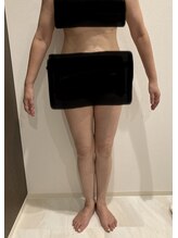 リセル(RECELL)/痩身スタート　お腹と太腿