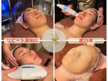 カメリー座薫 大阪上本町本店/顔の悩み！お任せください～♪