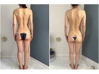 モア(moa)/肩甲骨/肩凝り/背面ケア/茅ヶ崎