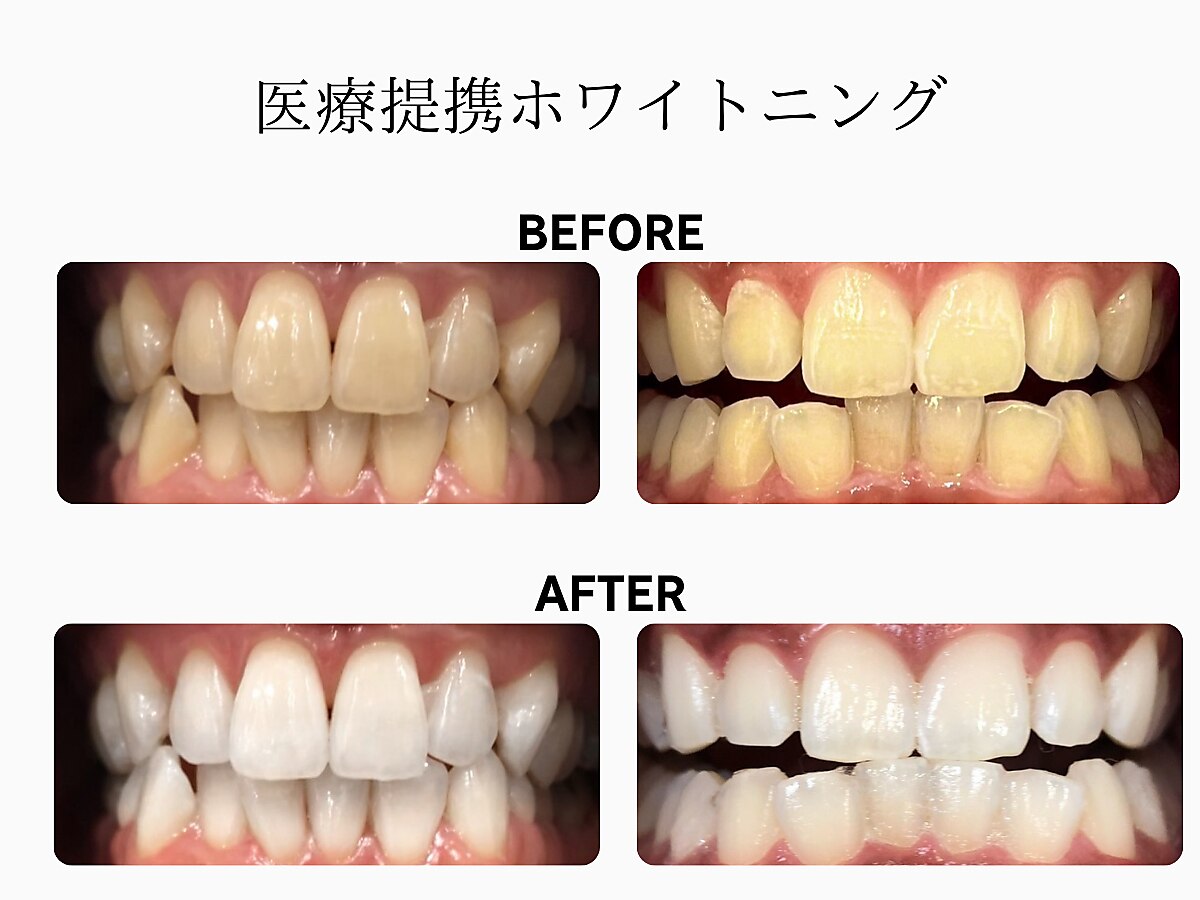 セイ(sei)｜ホットペッパービューティー
