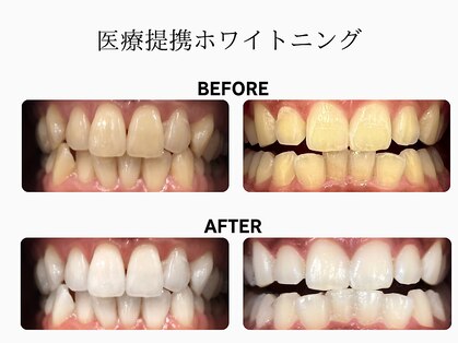 セイ(sei)の写真