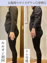 ヨサパーク シュエット(YOSA PARK CHOUETTE) 老廃物を デトックス