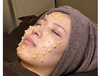 スリー ときわ台(Three)の写真/シワ改善/エイジングケアに◎【マイクロニードルピーリング】認定資格店しか行えない施術で高効果！ハリUP