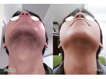 アネル うるま店(anel)/