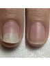 【トラブル爪専門ケア】剥離・浮爪を整えるネイルケア（専用育成オイル込）
