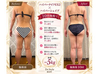 ドクタースタイル(Dr.style)/10回目/三ヶ月♪-5kg(マエナス)