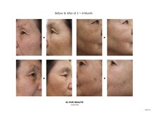 サラモ(Sa La Mo)/人生を変える化粧品（Dr.PUR）