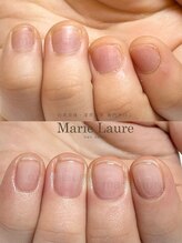 マリーロール 梅田店(Marie Laure)/自爪育成/深爪矯正/ネイルケア