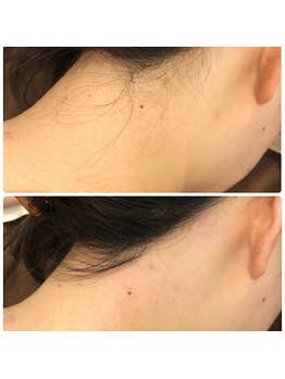 ハレノヒ(HaLeNoHi)/【ブラジリアンワックス】