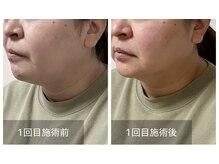 コントレイル(Contrail)の雰囲気（優しく深い圧で緩めて引き上げるヘッドスパ）