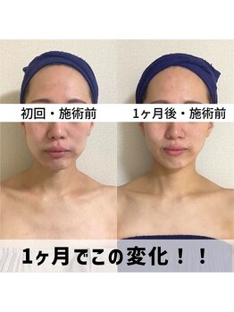 お顔の研究所/ビフォーアフター写真♪