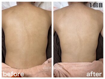 ダルセーニョ/美しい背中は健康への一歩です！