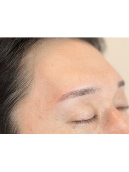 顔脱毛がしたい