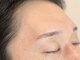 ノエル(NoёL)の写真/フェイシャルWAXで垢抜け♪お顔の産毛,角質除去により、お肌がワントーン明るく印象UP＆メイク時短にも◎