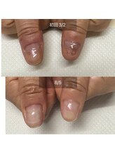 シープラス/お悩み爪　ご相談ください