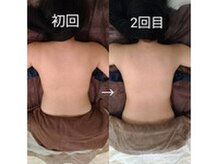 ヘッドリセット 麻布十番/深筋膜ヘッドスパ*筋膜をほぐす