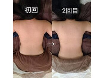 ヘッドリセット 麻布十番/深筋膜ヘッドスパ*筋膜をほぐす