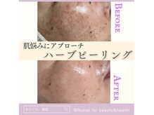 ルシアル(Rucial)の雰囲気（1年継続→肌悩み(赤み・シミ)軽減効果実感◎究極の肌管理♪♪）
