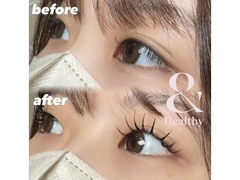 エルメ(elme)の写真/SNSで話題の＆ヘルシーで可愛く盛れる目元を再現★下がりまつ毛改善◎ぱっちりなお目元が叶う♪
