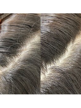 シュール センター南(SURREAL)/ヘッドスパ後のビフォーアフター