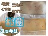 韓国肌管理【背中or首デコルテのピーリング】ハイドラ毛穴洗浄¥8,900　　　　