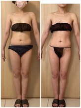 エステサロン エレガンス/