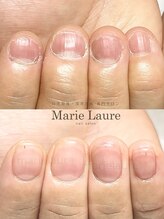マリーロール 淀屋橋本店(Marie Laure)/自爪育成/深爪矯正/ネイルケア